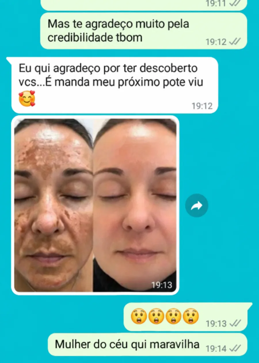 Cliente falando sobre o Amazolé no WhatsApp