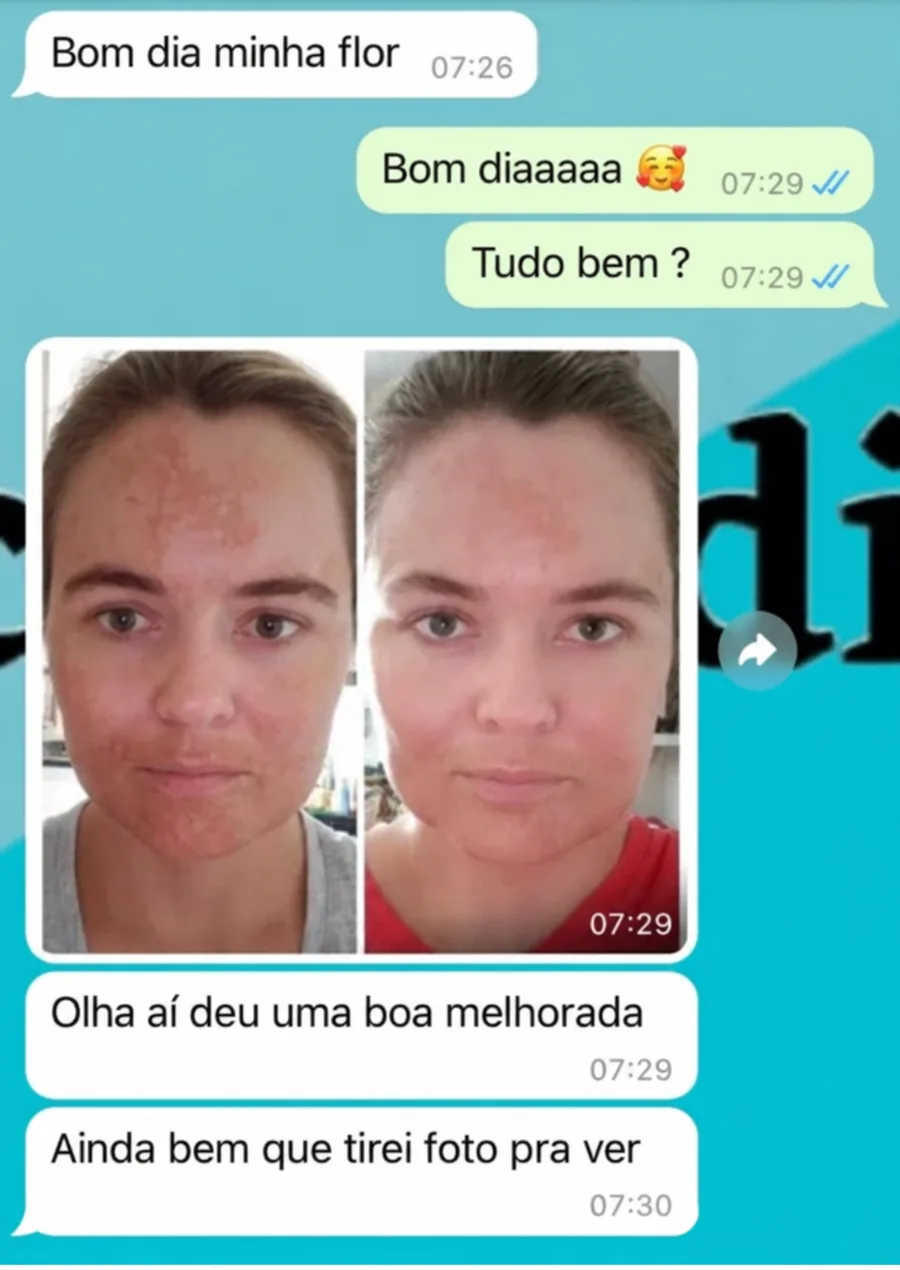 Print de cliente que recebeu Amazolé
