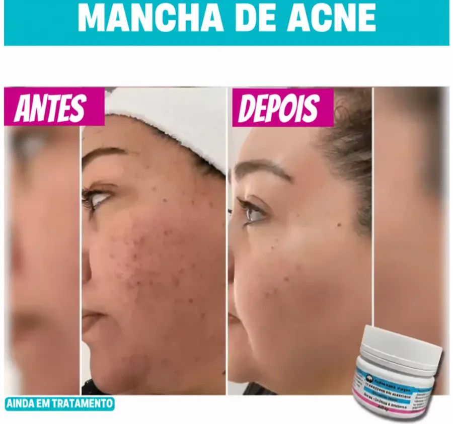 Resultado de uso do Amazolé