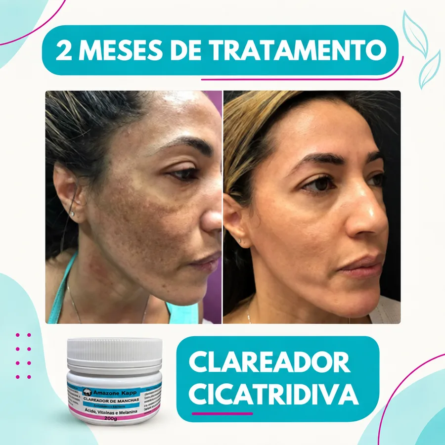 Prova visual de resultado com Amazolé